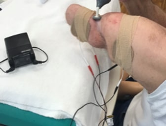 amputation 01 amputation 01